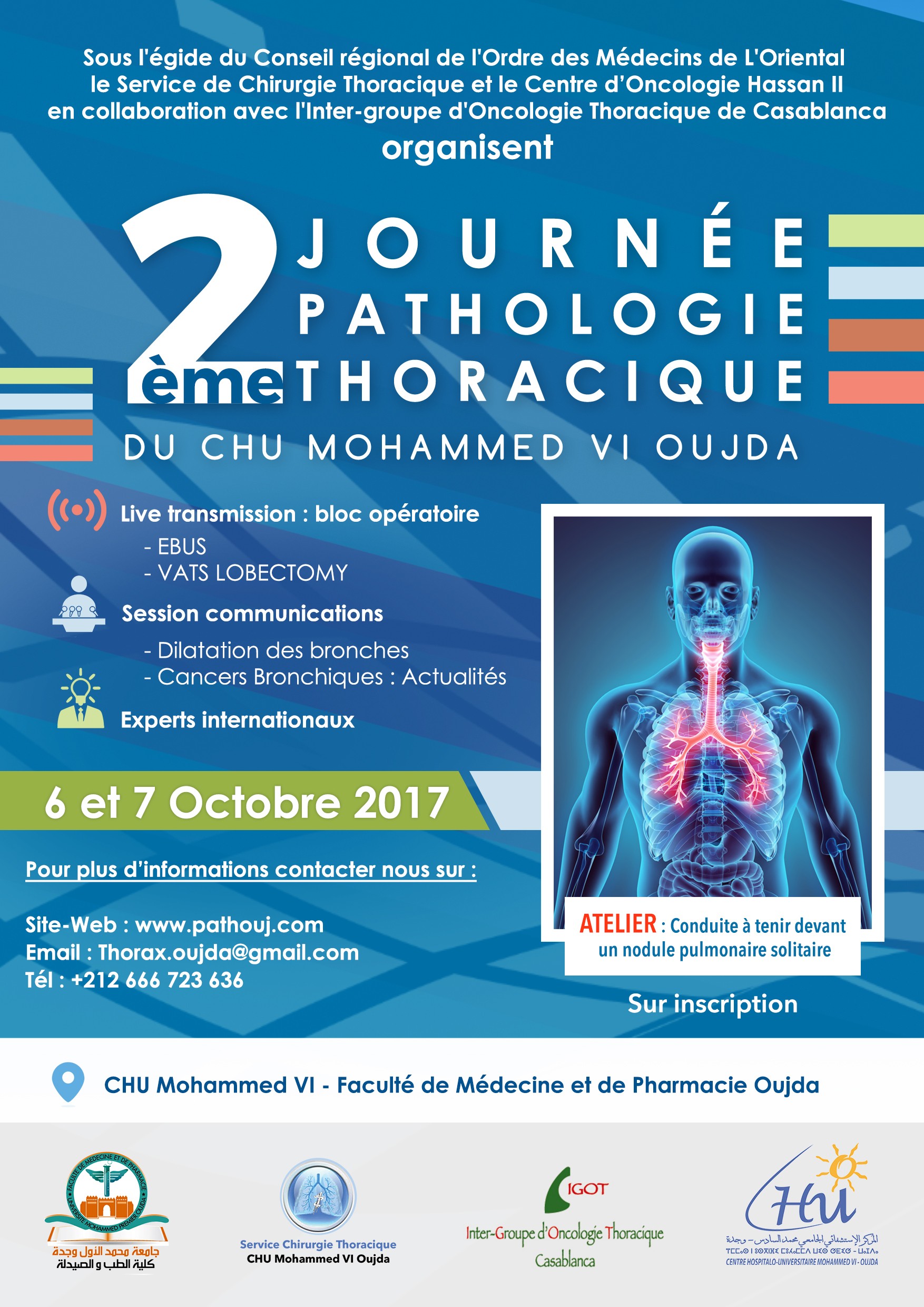 2éme journée d’oncologie thoracique